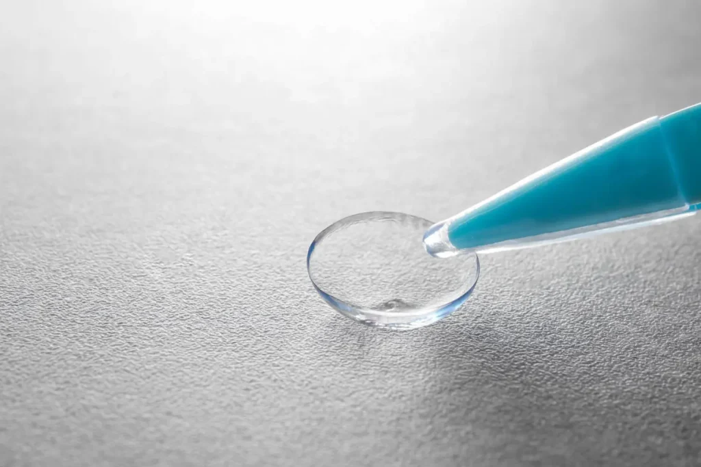 Lente intraocular transparente utilizada para sustituir el cristalino en la cirugía de cataratas